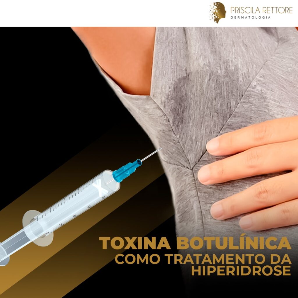 toxina botulínica