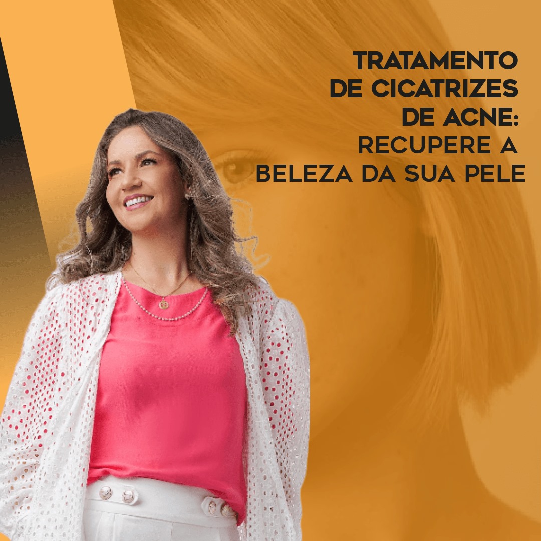 cicatrizes de acne