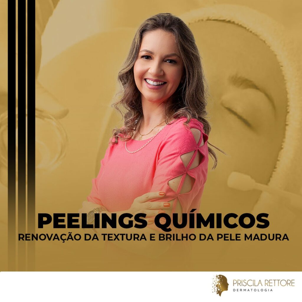 peelings químicos