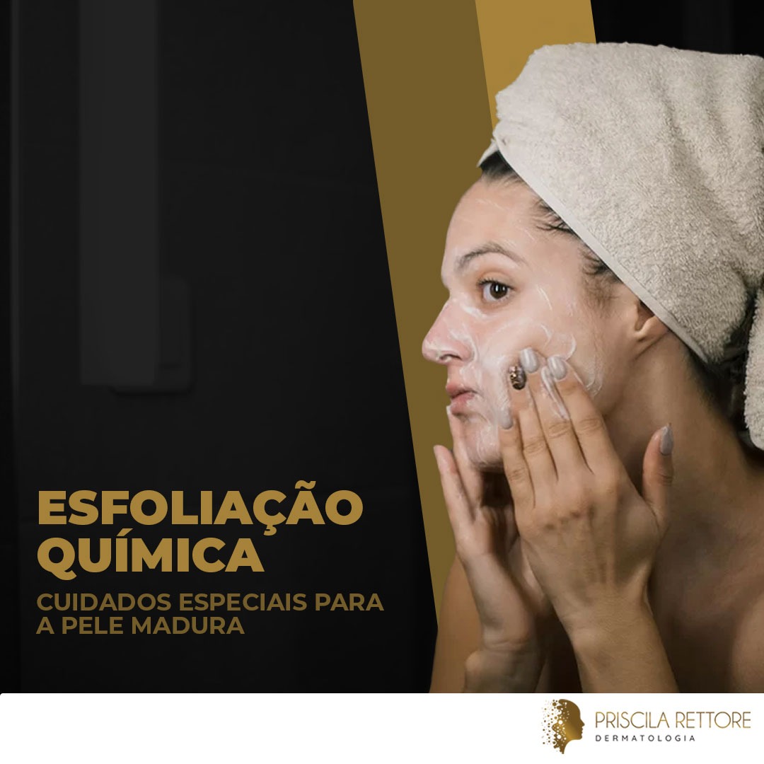 Esfoliação Química Cuidados Especiais para a Pele Madura