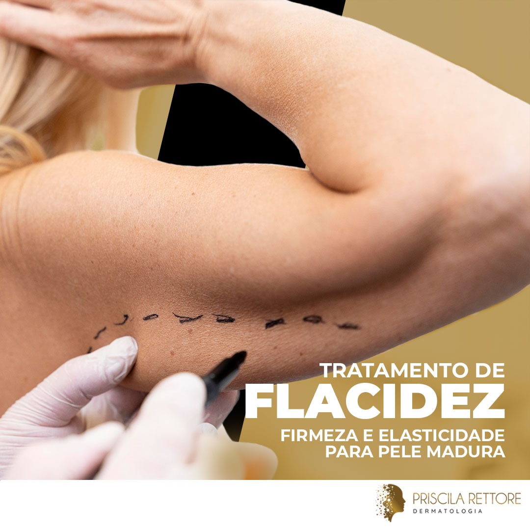 Flacidez