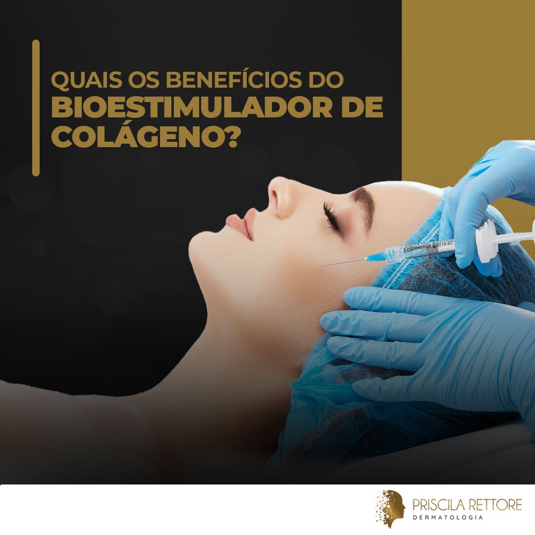 Quais os benefícios do bioestimulador de colágeno?