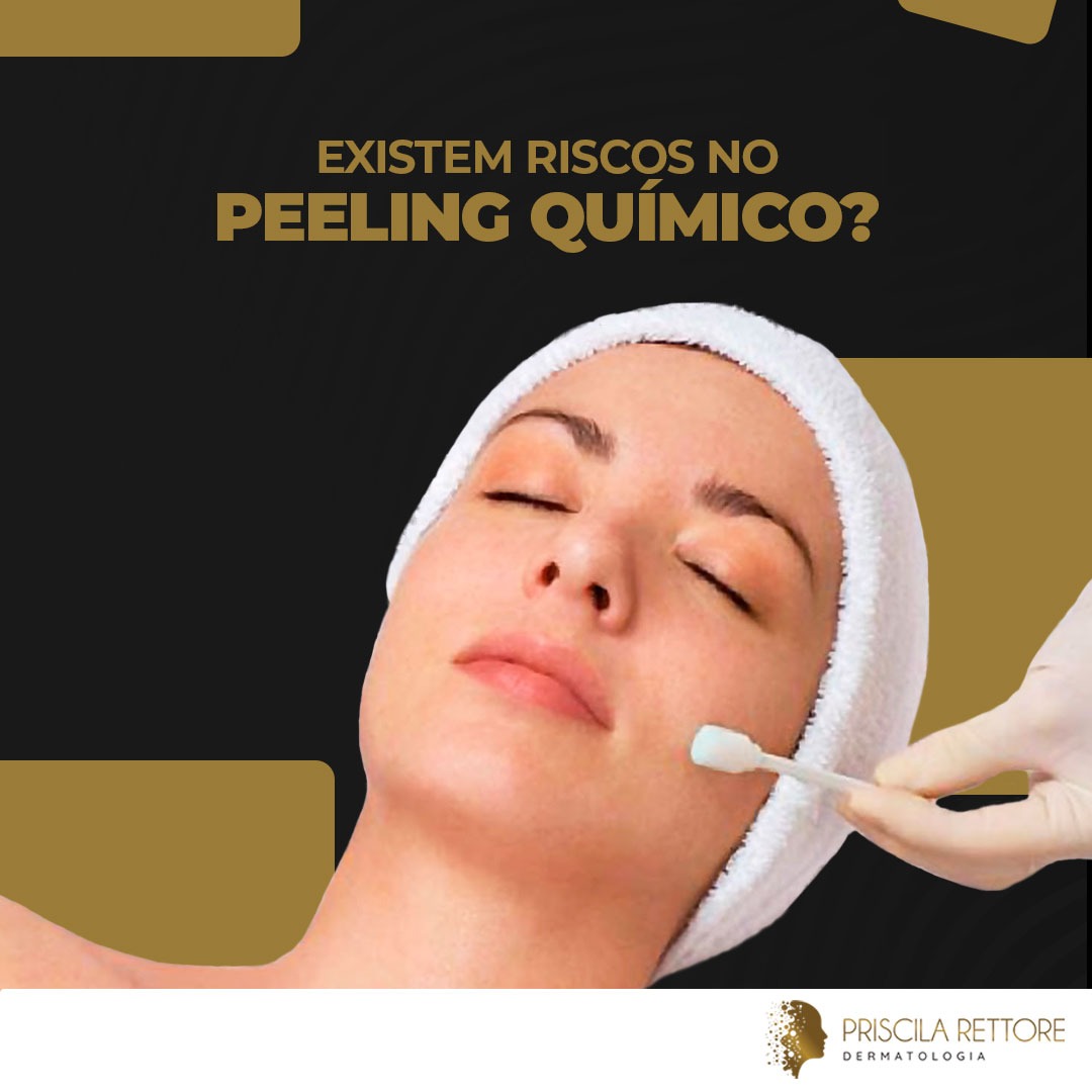 Existem riscos no peeling químico