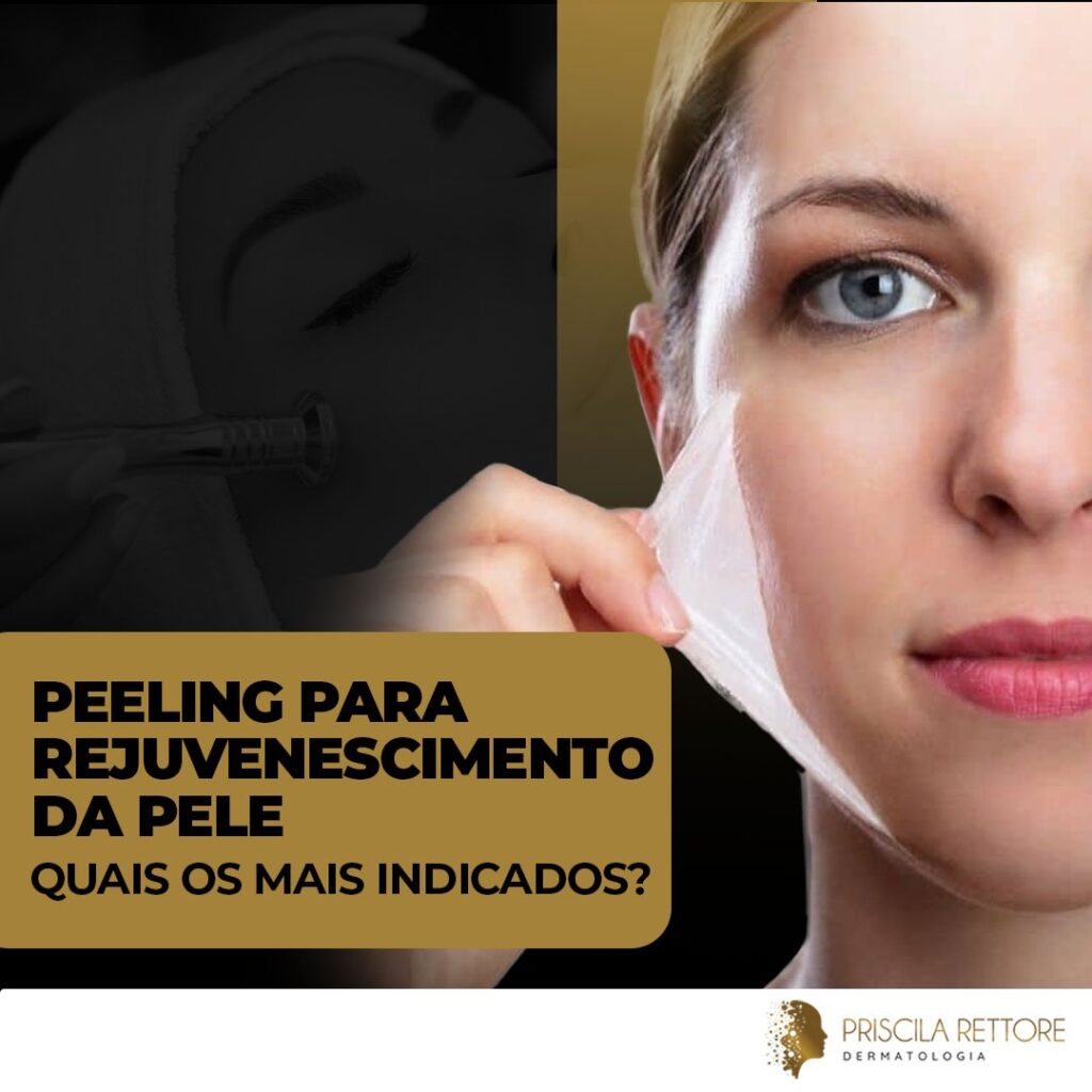 Peeling para rejuvenescimento da pele, quais os mais indicados