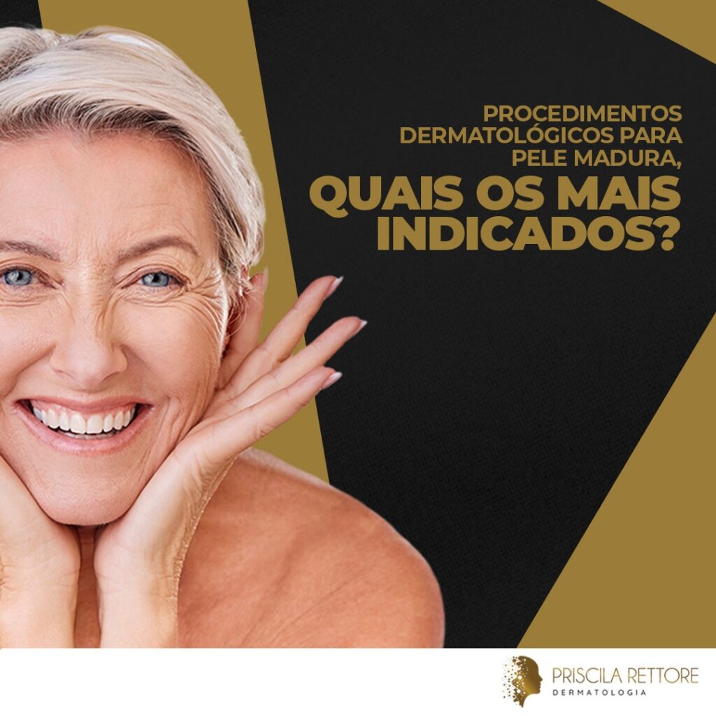 Procedimentos dermatológicos para pele madura