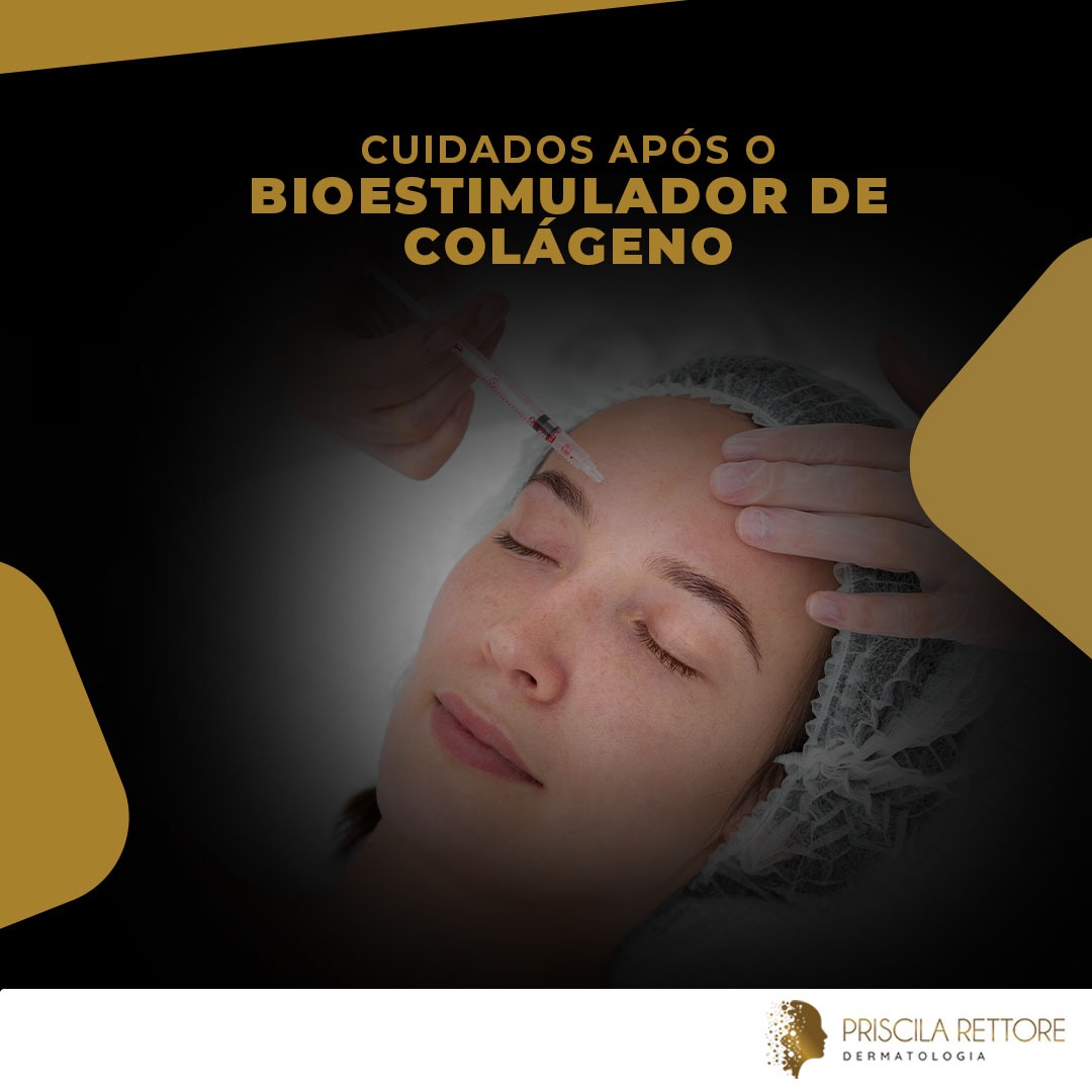Cuidados após o bioestimulador de colágeno: é possível otimizar os resultados?
