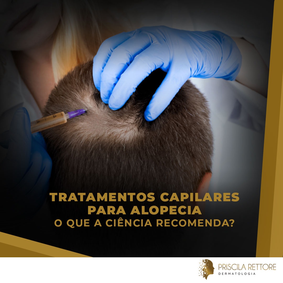 Tratamentos Avançados para Alopecia O que a Ciência Recomenda