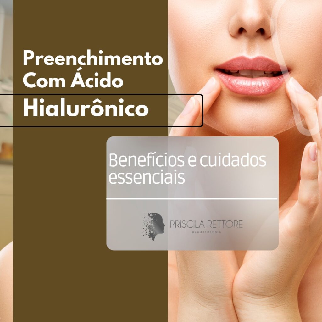 preenchimento com ácido hialurônico