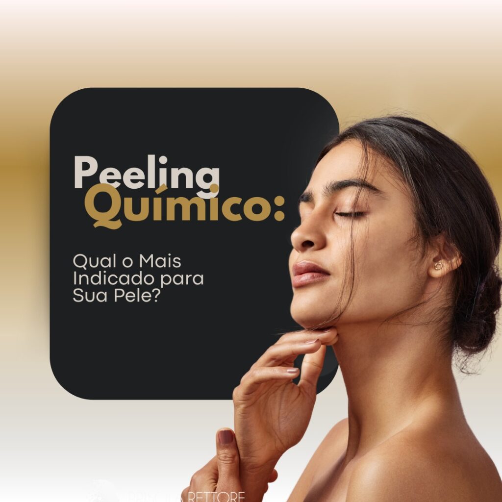 peeling químico