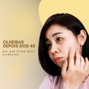 olheiras depois dos 40